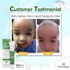 ครีมแก้ผื่นคัน ผิวภูมิแพ้